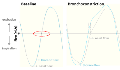 Specific airway resistance sRaw