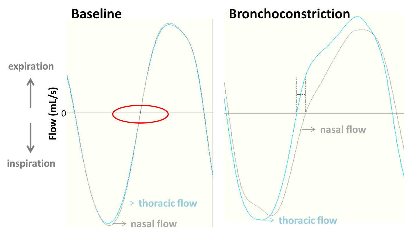 What You Always Wanted To Know About Specific Airway Resistance SCIREQ