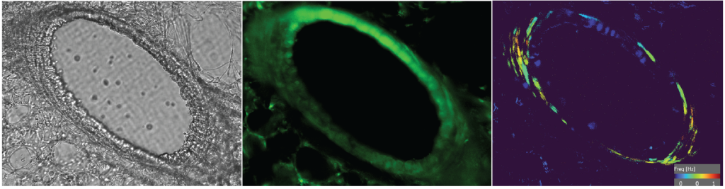 Calcium oscillations
