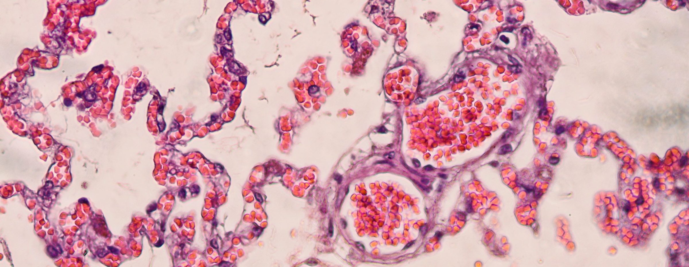 Cross,Section,Lung,Tissue,With,Hematoxilin,And,Eosin,(h&e),Stain